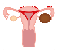 子宮内膜や卵質の改善